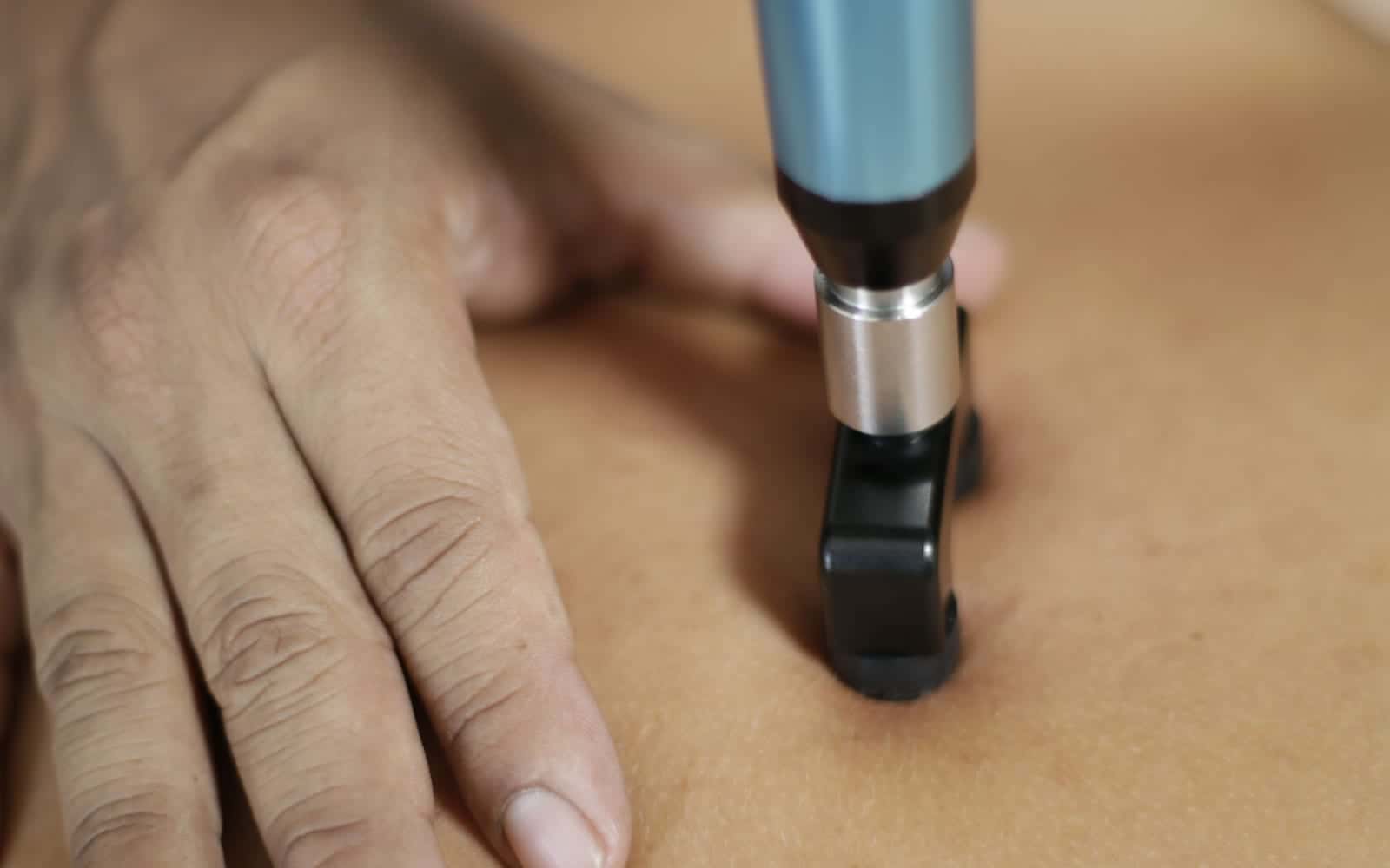 A shock wave therapy handpiece applied to a patient's back
