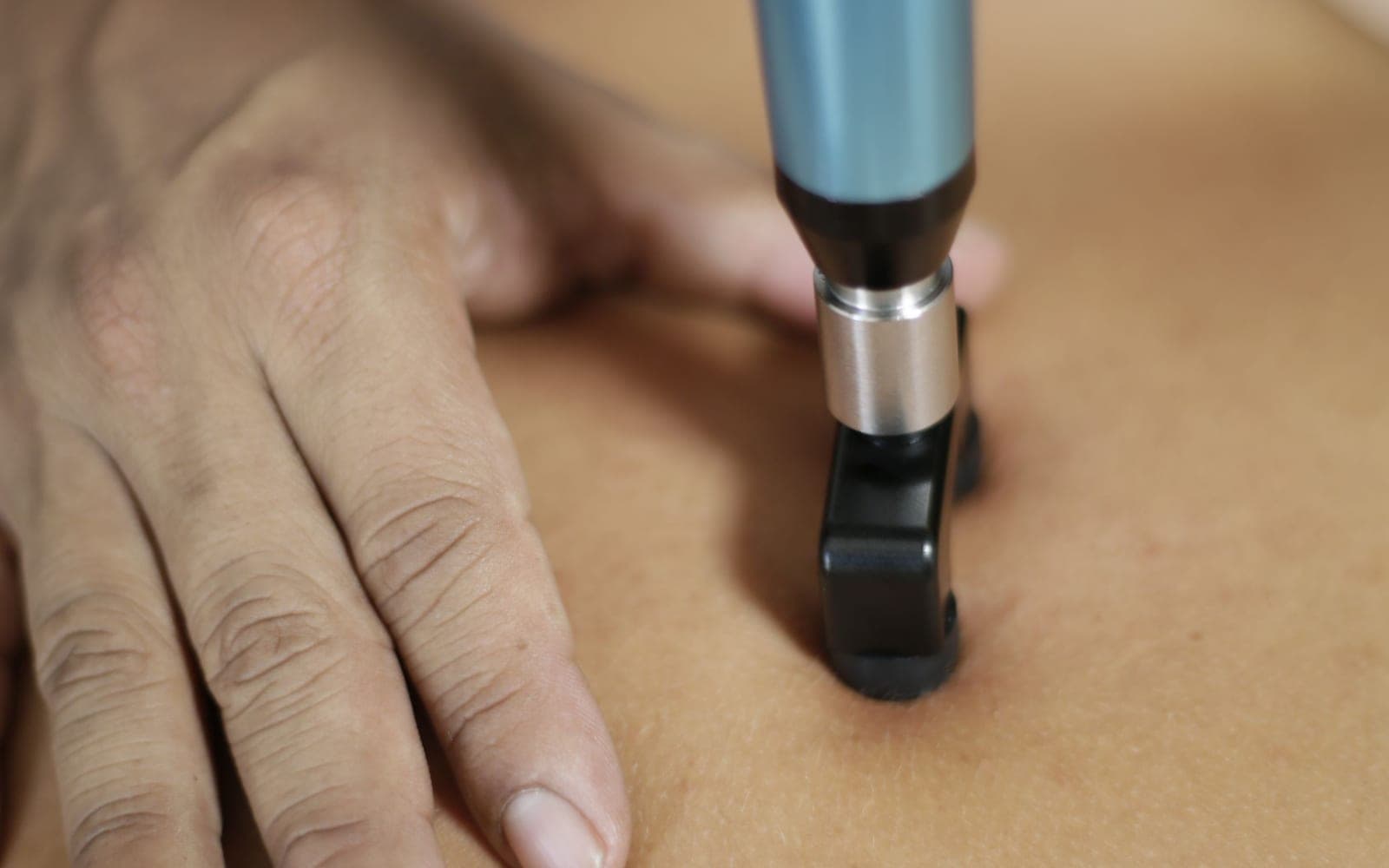 A shock wave therapy handpiece applied to a patient's back